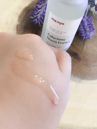 [마녀 공장] 발가락 토미 니아신 에센스 50ml — 5점을 준 리뷰어가 2019년 5월 올린 사용 사진