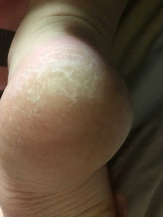 피치피치님이 올린 리뷰 사진 4