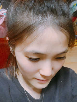 다슈코리아 다슈 데일리 헤어라인 커버 쿠션 — 2.67점을 준 리뷰어가 2017년 5월 올린 사용 사진