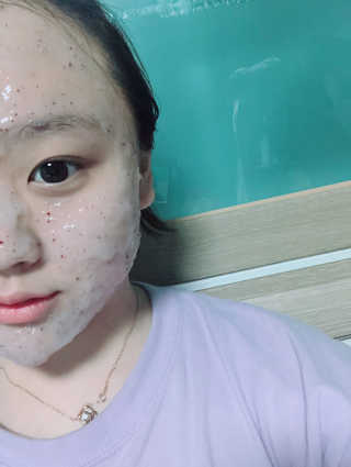 23years old 아쿠아밥 모델링 마스크 — 5점을 준 리뷰어가 2018년 5월 올린 사용 사진
