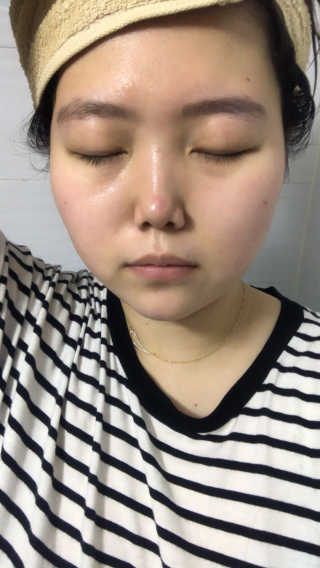 23years old 바데카실 오리지널 — 2.83점을 준 리뷰어가 2018년 3월 올린 사용 사진