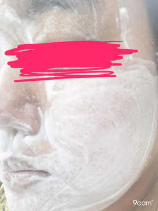 젠틀닥터 블랙 앤 화이트 포어 퓨리파잉 클렌징 바 — 4점을 준 리뷰어가 2017년 8월 올린 사용 사진