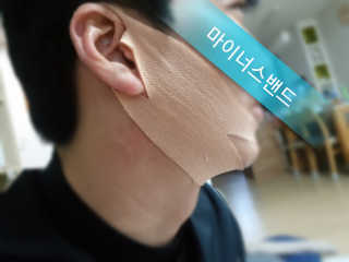 아이디플라코스메틱 아이디 페이스핏 마이너스 밴드 — 4점을 준 리뷰어가 2019년 11월 올린 사용 사진