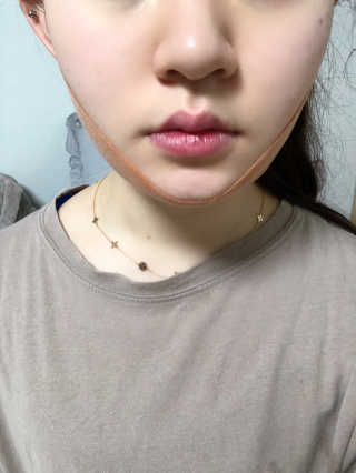 아이디플라코스메틱 아이디 페이스핏 마이너스 밴드 — 4점을 준 리뷰어가 2020년 3월 올린 사용 사진