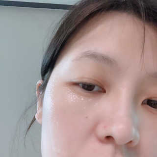 메디타임 멜라반 더마 토닝 씬젤 — 5점을 준 리뷰어가 2019년 5월 올린 사용 사진