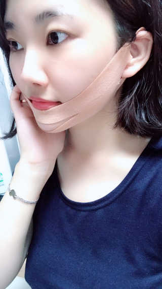 아이디플라코스메틱 아이디 페이스핏 마이너스 밴드 — 5점을 준 리뷰어가 2019년 9월 올린 사용 사진