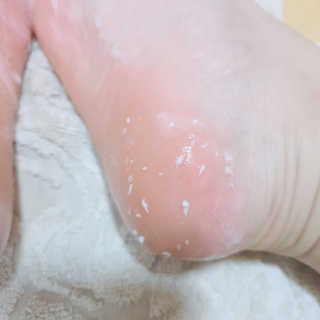 아미니 릴렉싱 풋 필링 스프레이 — 3.5점을 준 리뷰어가 2019년 4월 올린 사용 사진