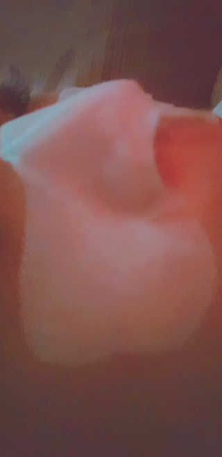 나이팅게일 TAKO PACK NOSE [문어코팩] — 5점을 준 리뷰어가 2018년 5월 올린 사용 사진