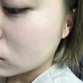 [라보드더마펌] 콜라제닉 미네랄 파우더 — 5점을 준 리뷰어가 2019년 9월 올린 사용 사진