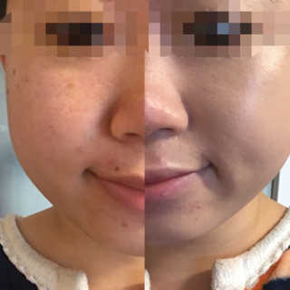 이상아님이 올린 리뷰 사진 1