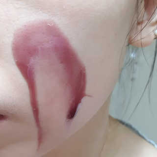 쏘내추럴 레드 필 팅글 세럼 오리지널 — 5점을 준 리뷰어가 2019년 8월 올린 사용 사진