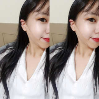아이디플라코스메틱 아이디 페이스핏 마이너스 밴드 — 5점을 준 리뷰어가 2019년 9월 올린 사용 사진