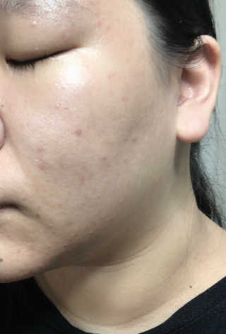 시큼한고냥이님이 올린 리뷰 사진 2
