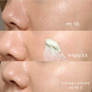 셀퓨전씨 카밍 다운 크림 — 5점을 준 리뷰어가 2018년 11월 올린 사용 사진