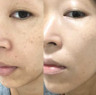 지고트 미네랄 UV 스네일 쿠션 리필포함 — 5점을 준 리뷰어가 2019년 7월 올린 사용 사진