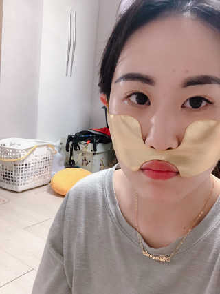 [스케덤] 상악밴드 — 3점을 준 리뷰어가 2019년 7월 올린 사용 사진