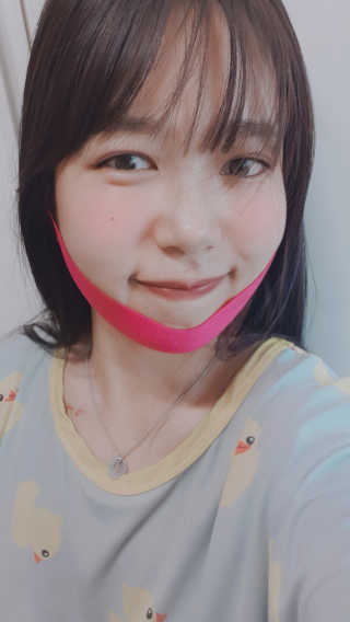 스케덤 펩타이드 리프팅밴드 — 4점을 준 리뷰어가 2019년 6월 올린 사용 사진