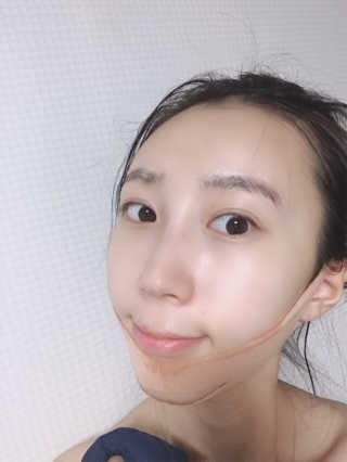 아이디플라코스메틱 아이디 페이스핏 마이너스 밴드 — 5점을 준 리뷰어가 2019년 11월 올린 사용 사진