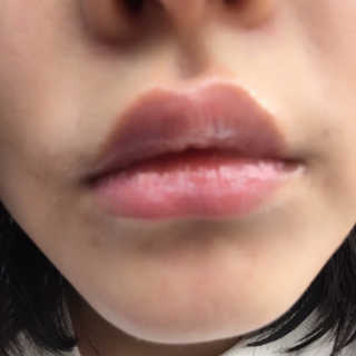 블리스텍스 립 릴리프 크림 립밤, 립 바이브런스 립밤 — 5점을 준 리뷰어가 2018년 11월 올린 사용 사진