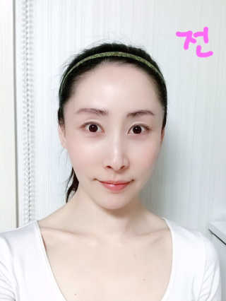 키노닉스 Querencia_Flawless 마스크팩 — 4.5점을 준 리뷰어가 2019년 4월 올린 사용 사진