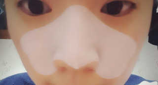 나이팅게일 TAKO PACK NOSE [문어코팩] — 5점을 준 리뷰어가 2017년 4월 올린 사용 사진