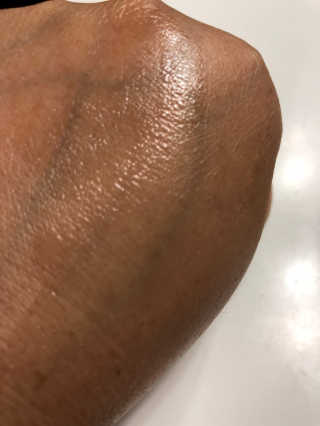 앰플엔 AMPLEN VC SHOT AMPOULE — 5점을 준 리뷰어가 2018년 9월 올린 사용 사진