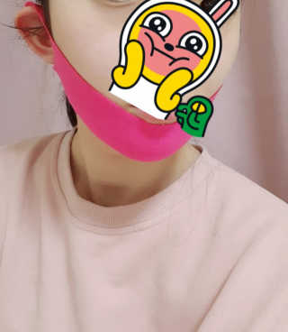 스케덤 펩타이드 리프팅밴드 — 5점을 준 리뷰어가 2019년 3월 올린 사용 사진