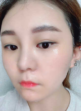 메디타임 멜라반 더마 토닝 씬젤 — 2.5점을 준 리뷰어가 2019년 4월 올린 사용 사진