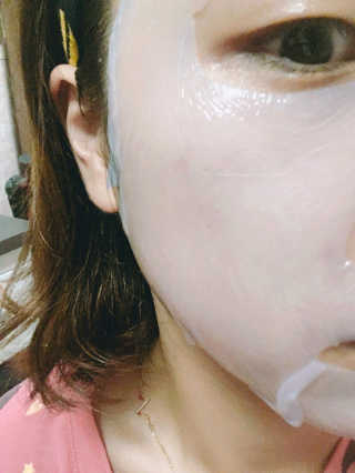 에슬레나 엑스트라 밸런싱 힐링 마스크 10장 — 5점을 준 리뷰어가 2017년 10월 올린 사용 사진