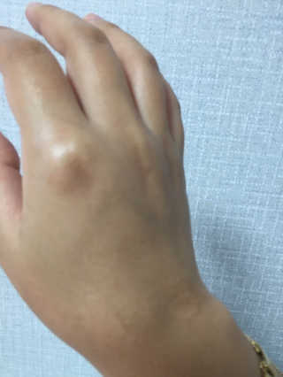 프리미어룩 실크 리프팅 아이 앤 넥 크림 — 5점을 준 리뷰어가 2019년 11월 올린 사용 사진