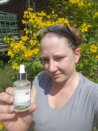 [마녀 공장] 발가락 토미 니아신 에센스 50ml — 5점을 준 리뷰어가 2018년 8월 올린 사용 사진