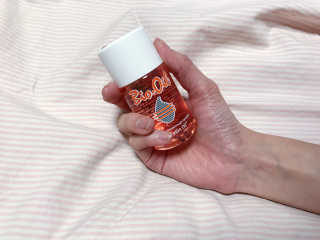 Bio-oil(바이오오일) 바이오오일(Bio-oil) — 4점을 준 리뷰어가 2017년 1월 올린 사용 사진