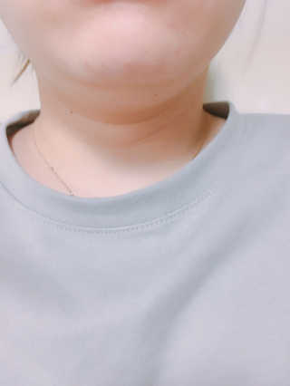 메디미 브이미 업 2스텝 브이라인벨트 — 5점을 준 리뷰어가 2017년 10월 올린 사용 사진