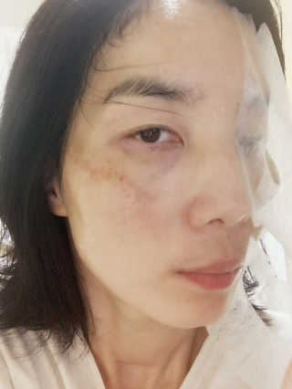 쥬시줄리 체리블라썸 젤리겔 마스크 — 4점을 준 리뷰어가 2020년 3월 올린 사용 사진