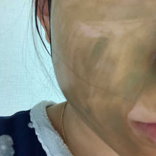 플러스셀라 시카골드 클렌징바 화산재팩 세트 — 5점을 준 리뷰어가 2020년 3월 올린 사용 사진