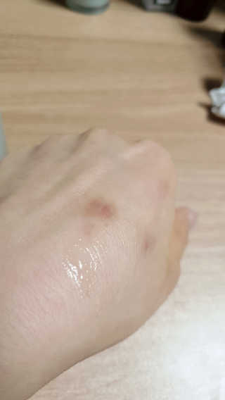 (주)에네스티 미스랩 갈락토미세스 엔리치드 앰플 — 5점을 준 리뷰어가 2019년 12월 올린 사용 사진
