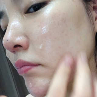 본다움 알로에 베라 수딩젤 — 4.5점을 준 리뷰어가 2019년 6월 올린 사용 사진