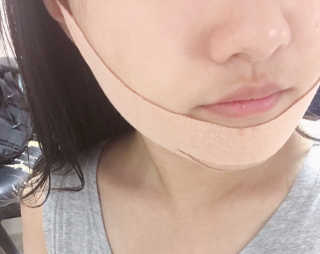 아이디플라코스메틱 아이디 페이스핏 마이너스 밴드 — 5점을 준 리뷰어가 2019년 9월 올린 사용 사진