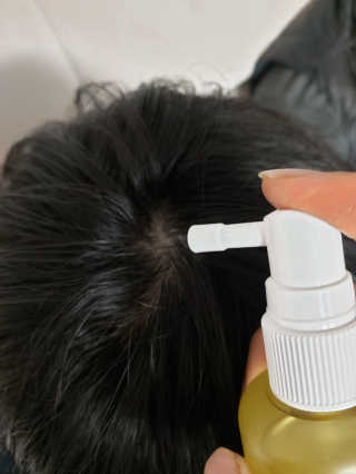 다슈코리아 다슈 데일리 안티 헤어로스 허브 헤어토닉 150ml — 5점을 준 리뷰어가 2019년 12월 올린 사용 사진