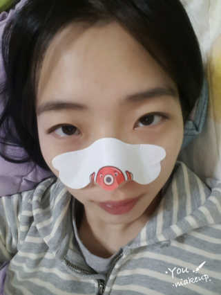 나이팅게일 TAKO PACK NOSE [문어코팩] — 4점을 준 리뷰어가 2017년 1월 올린 사용 사진