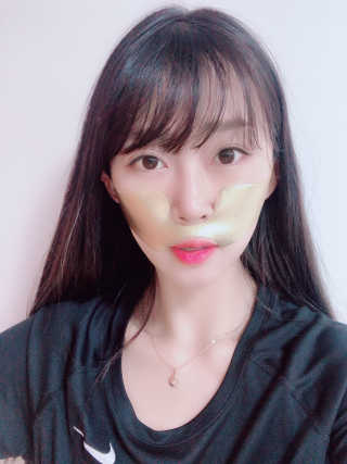 [스케덤] 상악밴드 — 4.5점을 준 리뷰어가 2019년 6월 올린 사용 사진
