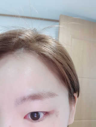 비알티씨 더 퍼스트 앰플 에센스 — 5점을 준 리뷰어가 2019년 4월 올린 사용 사진