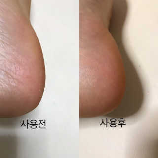 아미니 릴렉싱 풋 필링 스프레이 — 4점을 준 리뷰어가 2019년 4월 올린 사용 사진