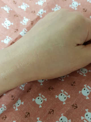 보타니티 [홍]조[진]정[결]케어 플라본 세럼 — 5점을 준 리뷰어가 2018년 5월 올린 사용 사진