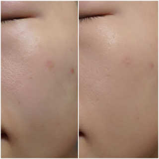 beauty_chanran님이 올린 리뷰 사진 2