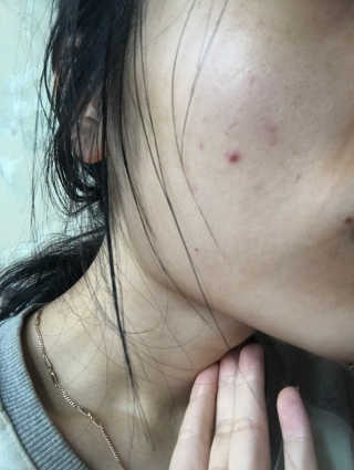 라포랩 laforlab 라포랩 센텔라스카 연고(바질) — 4.5점을 준 리뷰어가 2017년 12월 올린 사용 사진