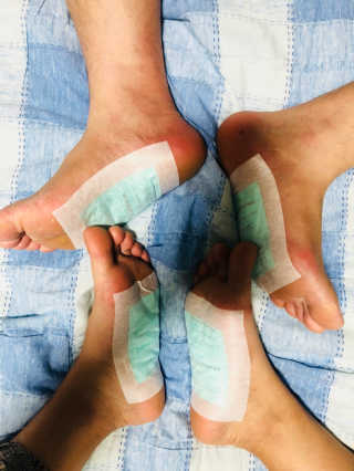 메디테라피 더마 릴렉스 힐링패치 — 3.67점을 준 리뷰어가 2018년 4월 올린 사용 사진