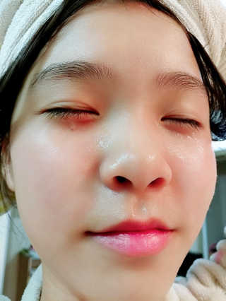 최윤하스텔라 최윤하 만물상 올인원 만능크림 — 5점을 준 리뷰어가 2018년 10월 올린 사용 사진