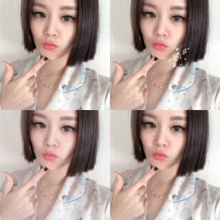 아이디플라코스메틱 아이디 페이스핏 마이너스 밴드 — 5점을 준 리뷰어가 2019년 9월 올린 사용 사진