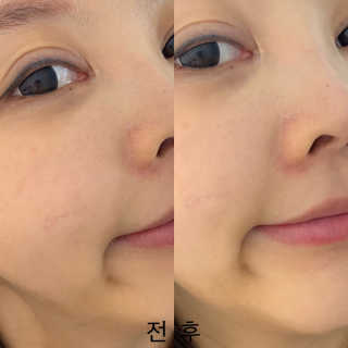미니님이 올린 리뷰 사진 2